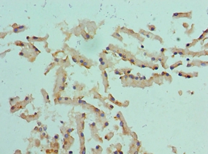 CST1 Polyclonal Antibody