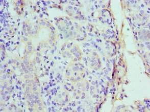 CST1 Polyclonal Antibody