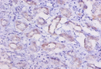 Cathepsin K Polyclonal Antibody