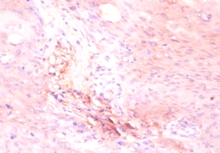 ATP synthase subunit delta Polyclonal Antibody