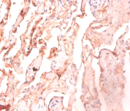 ATP synthase subunit delta Polyclonal Antibody