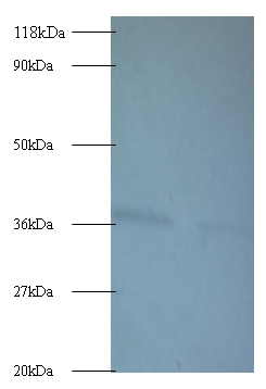 ATP synthase subunit delta Polyclonal Antibody