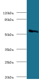 Cholesterol side-chain cleavage enzyme, mitochondrial Polyclonal Antibody