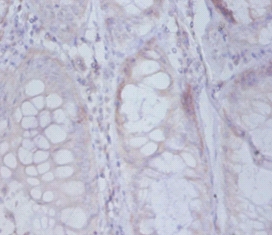 Active regulator of SIRT1 Polyclonal Antibody
