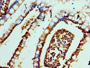 DEFA1 Polyclonal Antibody