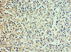 DEFA1 Polyclonal Antibody