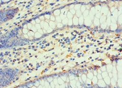 DLX3 Polyclonal Antibody