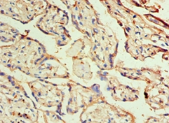 DLX3 Polyclonal Antibody