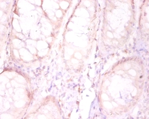 Protein FAM110B Polyclonal Antibody