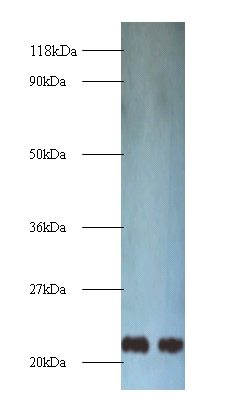 Transgelin Polyclonal Antibody