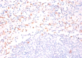 Cytidine deaminase Polyclonal Antibody