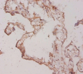 Fibroblast growth factor 1 Polyclonal Antibody