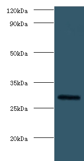 Fibroblast growth factor 23 Polyclonal Antibody