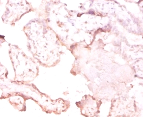 Putative tRNA (cytidine(32)/guanosine(34)-2'-O)-methyltransferase Polyclonal Antibody