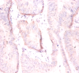 ADP-ribosylation factor 4 Polyclonal Antibody