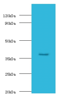 Galactose-1-phosphate uridylyltransferase Polyclonal Antibody