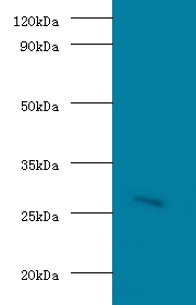 Guanidinoacetate N-methyltransferase Polyclonal Antibody