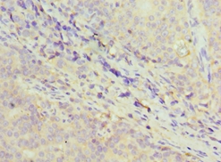 GDF5 Polyclonal Antibody