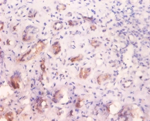 Alpha-galactosidase A Polyclonal Antibody