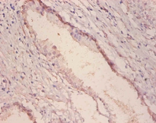Alpha-galactosidase A Polyclonal Antibody
