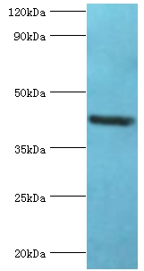GOLM1 Polyclonal Antibody