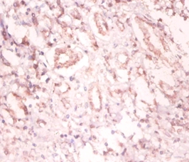 U1 small nuclear ribonucleoprotein A Polyclonal Antibody
