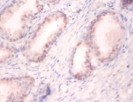 U1 small nuclear ribonucleoprotein A Polyclonal Antibody