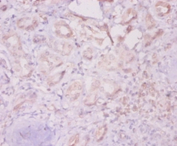 Integrin-linked protein kinase Polyclonal Antibody