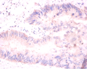 Histone H2A.J Polyclonal Antibody