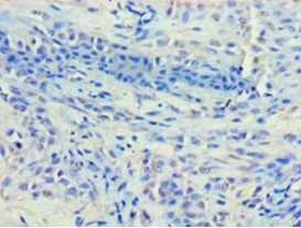 Histone deacetylase 8 Polyclonal Antibody
