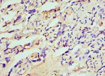 HIP1 Polyclonal Antibody