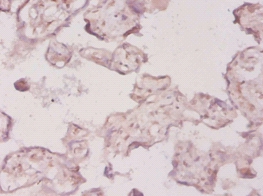 3-hydroxy-3 methylglutaryl-coenzyme A reductase Polyclonal Antibody