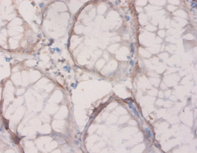 4-hydroxyphenylpyruvate dioxygenase Polyclonal Antibody