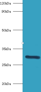 Indolethylamine N-methyltransferase Polyclonal Antibody