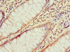 IRAK2 Polyclonal Antibody