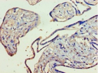 Kynurenine 3-monooxygenase Polyclonal Antibody