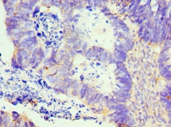 LMOD1 Polyclonal Antibody