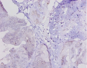 Lysyl oxidase homolog 1 Polyclonal Antibody