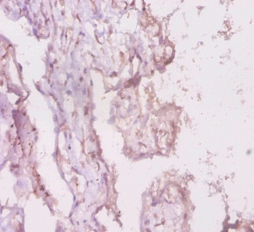 Lipopolysaccharide-responsive and beige-like anchor protein Polyclonal Antibody