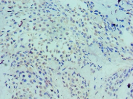 LRP6 Polyclonal Antibody