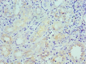 LRP6 Polyclonal Antibody