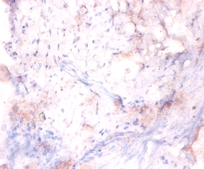 Leucine-rich repeat flightless-interacting protein 1 Polyclonal Antibody