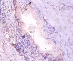 Proteasome subunit alpha type-7 Polyclonal Antibody
