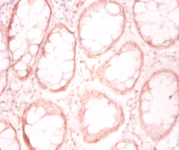Prefoldin subunit 1 Polyclonal Antibody