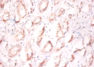 Prefoldin subunit 1 Polyclonal Antibody