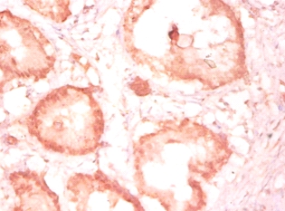 Cytochrome c1, heme protein, mitochondrial Polyclonal Antibody