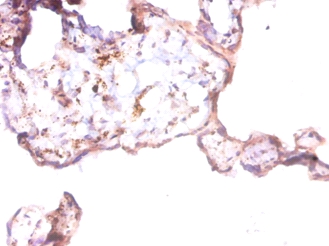 Prothymosin alpha Polyclonal Antibody