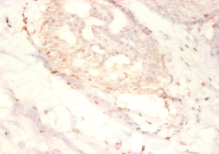 Small nuclear ribonucleoprotein G Polyclonal Antibody