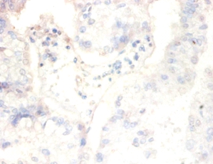 Casein kinase II subunit beta Polyclonal Antibody