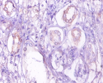 Phosphoenolpyruvate carboxykinase, cytosolic [GTP] Polyclonal Antibody